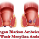 Illustration for article titled cara mengatasi wasir berdarah saat hamilem/em
